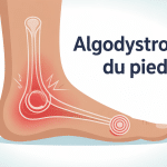 illustration algodystrophie pied : peut-on marcher