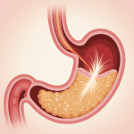 illustration cicatrisation estomac après bypass gastrique
